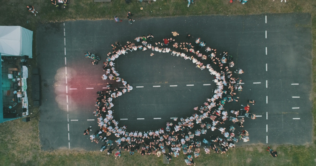 Festyn na pomoc Amelce z Wilkowyi